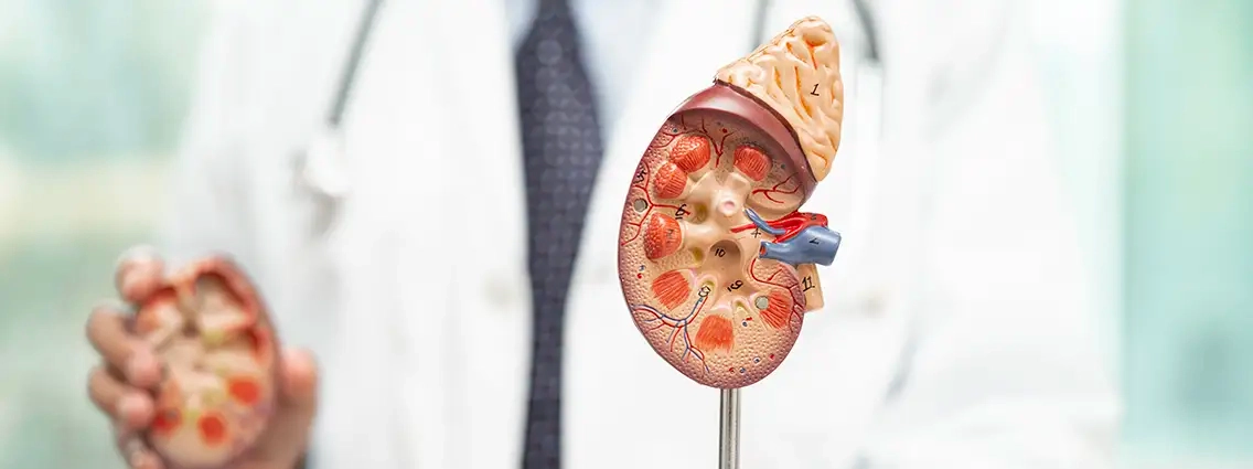 What Are the Benefits of IV Therapy for Kidney Stones?